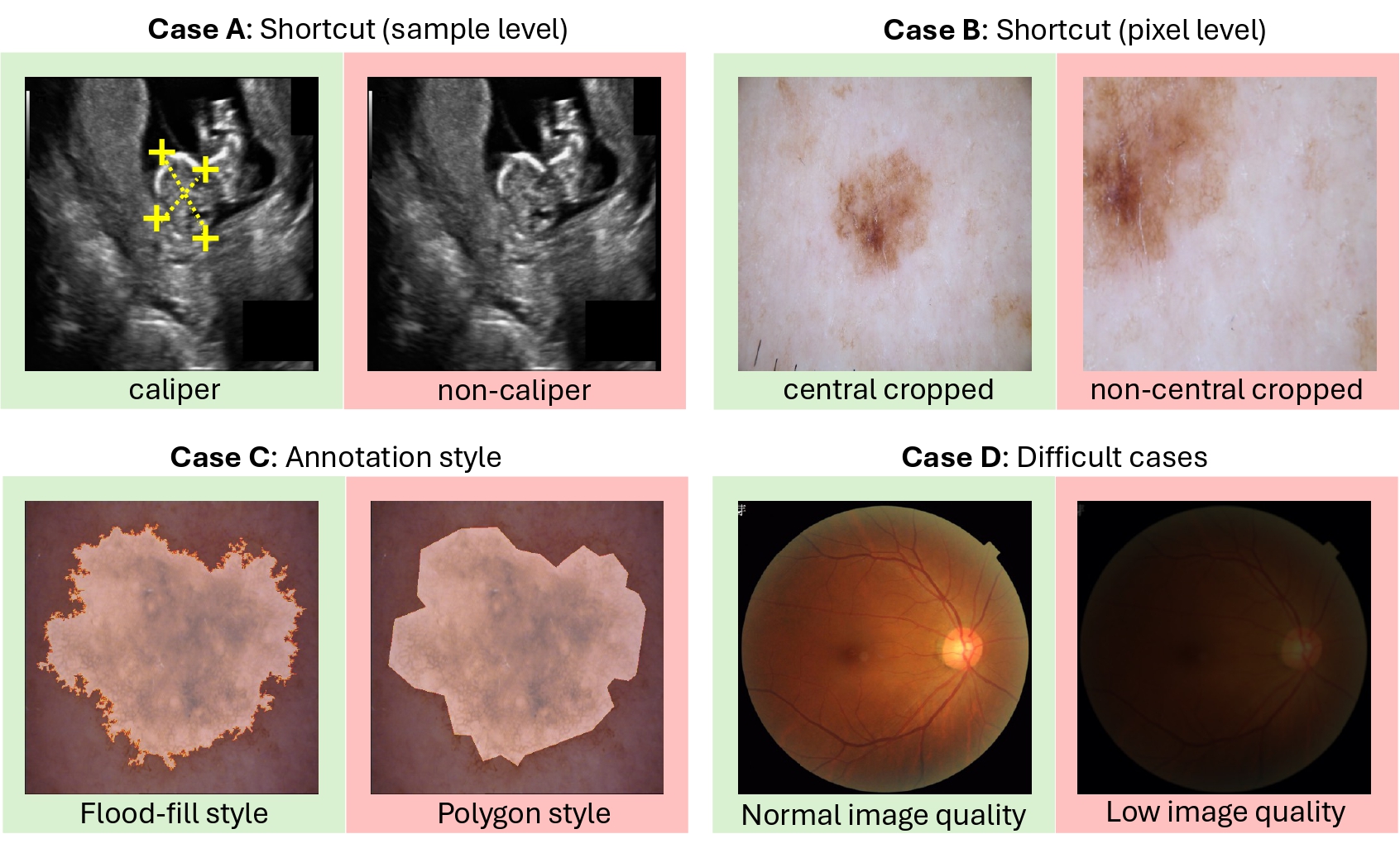 Overview of the four experimental cases